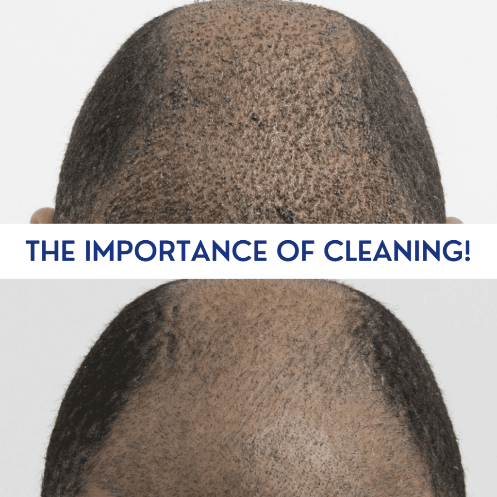 The importance of hair cleaning